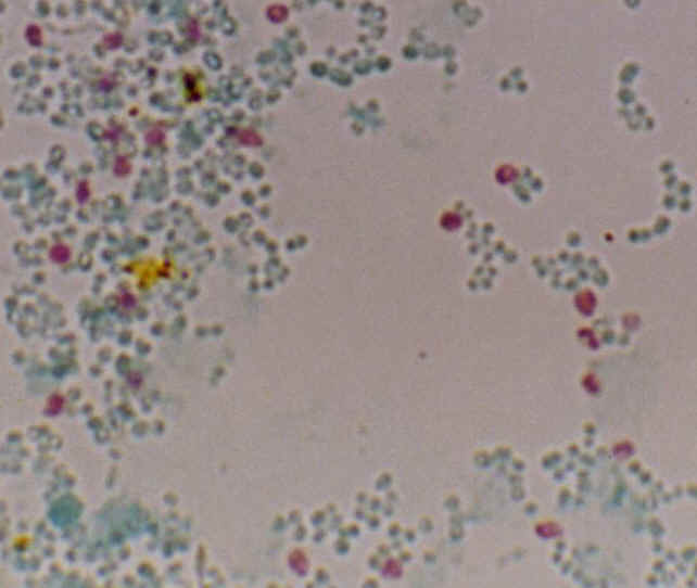 8100 Microsporidia